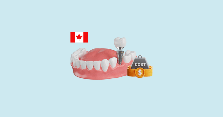 Discover the Cost of Full Mouth Dental Implants in Canada in 2025, including price ranges, key factors that influence cost, and the best clinics.